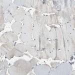 HRD1 Antibody in Immunohistochemistry (Paraffin) (IHC (P))