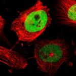 TPX2 Polyclonal Antibody