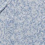 TPX2 Antibody in Immunohistochemistry (Paraffin) (IHC (P))