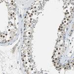TPX2 Antibody in Immunohistochemistry (Paraffin) (IHC (P))