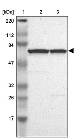 cIAP1 Antibody in Western Blot (WB)