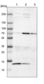 cIAP1 Antibody in Western Blot (WB)