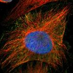 PRMT5 Polyclonal Antibody