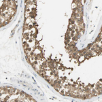 PRMT5 Antibody in Immunohistochemistry (Paraffin) (IHC (P))