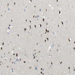 PRMT5 Antibody in Immunohistochemistry (Paraffin) (IHC (P))