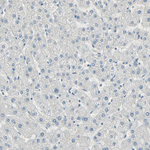 PRMT5 Antibody in Immunohistochemistry (Paraffin) (IHC (P))