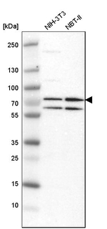 PRMT5 Antibody in Western Blot (WB)