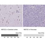 MEF2C Antibody