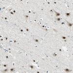 MTA1 Antibody in Immunohistochemistry (Paraffin) (IHC (P))