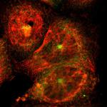 DLG7 Polyclonal Antibody