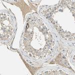 ACSL4 Antibody in Immunohistochemistry (Paraffin) (IHC (P))