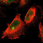 KEAP1 Polyclonal Antibody