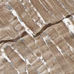 KEAP1 Antibody in Immunohistochemistry (Paraffin) (IHC (P))