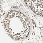 KEAP1 Antibody in Immunohistochemistry (Paraffin) (IHC (P))