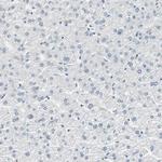 MSX2 Antibody in Immunohistochemistry (Paraffin) (IHC (P))