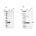 15-PGDH Antibody in Western Blot (WB)