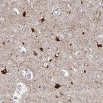 Anillin Antibody in Immunohistochemistry (Paraffin) (IHC (P))