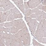 Anillin Antibody in Immunohistochemistry (Paraffin) (IHC (P))