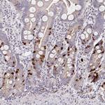 Anillin Polyclonal Antibody