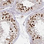 Anillin Antibody in Immunohistochemistry (Paraffin) (IHC (P))