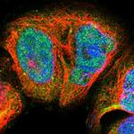 Blooms Syndrome Polyclonal Antibody