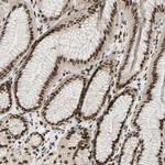 Blooms Syndrome Antibody in Immunohistochemistry (Paraffin) (IHC (P))
