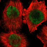 PPP2R4 Polyclonal Antibody