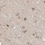 PPP2R4 Antibody in Immunohistochemistry (Paraffin) (IHC (P))