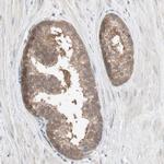 PPP2R4 Antibody in Immunohistochemistry (Paraffin) (IHC (P))
