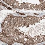 PPP2R4 Antibody in Immunohistochemistry (Paraffin) (IHC (P))