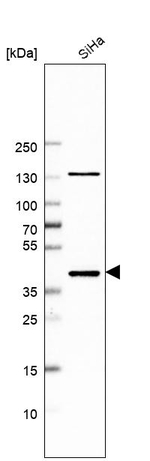 PPP2R4 Antibody in Western Blot (WB)