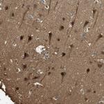 RPA14 Polyclonal Antibody