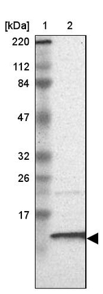 RPA14 Antibody in Western Blot (WB)