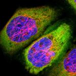 Fascin Polyclonal Antibody