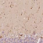 Fascin Antibody in Immunohistochemistry (Paraffin) (IHC (P))