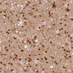 Fascin Antibody in Immunohistochemistry (Paraffin) (IHC (P))