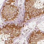 Fascin Antibody in Immunohistochemistry (Paraffin) (IHC (P))