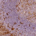 Fascin Antibody in Immunohistochemistry (Paraffin) (IHC (P))