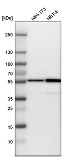 Fascin Antibody in Western Blot (WB)