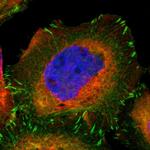 VASP Polyclonal Antibody