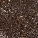 VASP Antibody in Immunohistochemistry (Paraffin) (IHC (P))