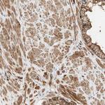 VASP Antibody in Immunohistochemistry (Paraffin) (IHC (P))