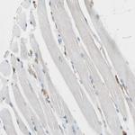 VASP Antibody in Immunohistochemistry (Paraffin) (IHC (P))