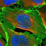 EPB41L2 Polyclonal Antibody