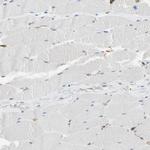 EPB41L2 Antibody in Immunohistochemistry (Paraffin) (IHC (P))
