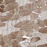 CNOT4 Antibody in Immunohistochemistry (Paraffin) (IHC (P))