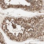 CNOT4 Antibody in Immunohistochemistry (Paraffin) (IHC (P))