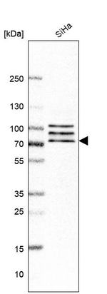 CNOT4 Antibody in Western Blot (WB)