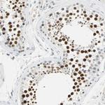 MLLT10 Antibody in Immunohistochemistry (Paraffin) (IHC (P))