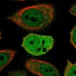 ZWINT Polyclonal Antibody